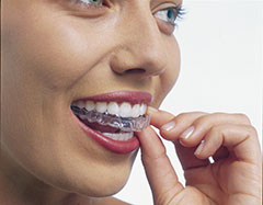 Invisalign®